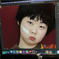 A screen capture of editing software on a computer working with the image of a person with a bandage on their face